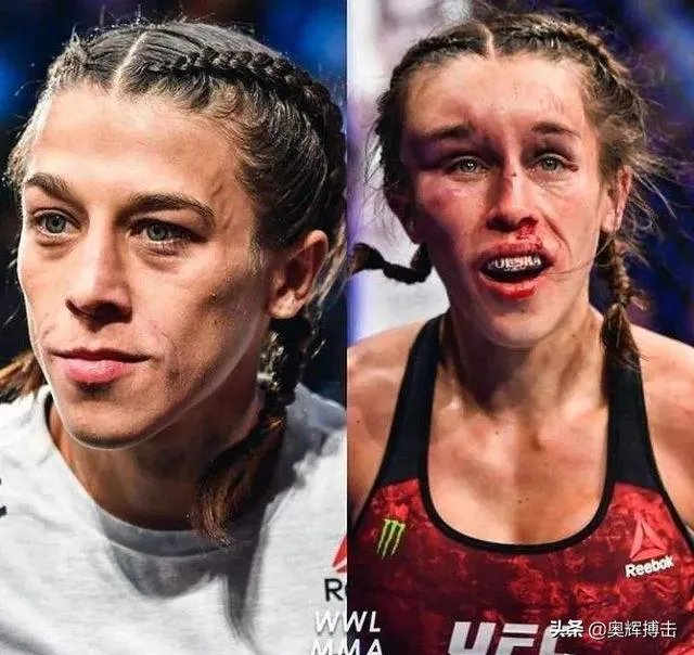 客观评价一下张伟丽和乔安娜个人能力，不吹不黑？