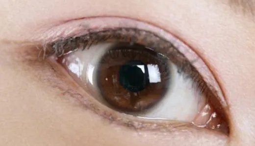 眼部埋线怎么样