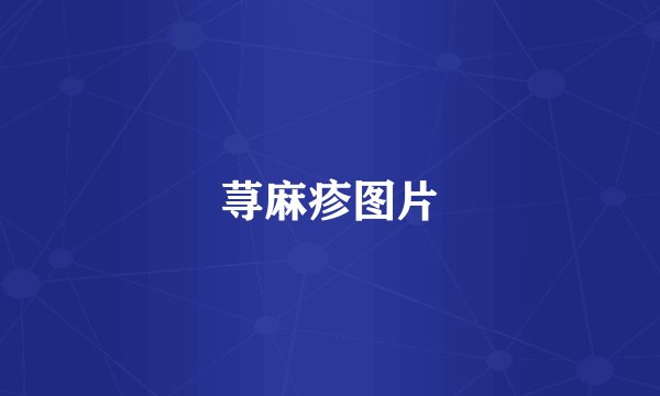 荨麻疹图片