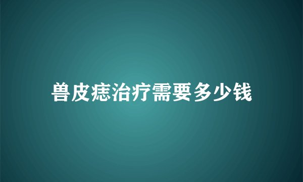 兽皮痣治疗需要多少钱