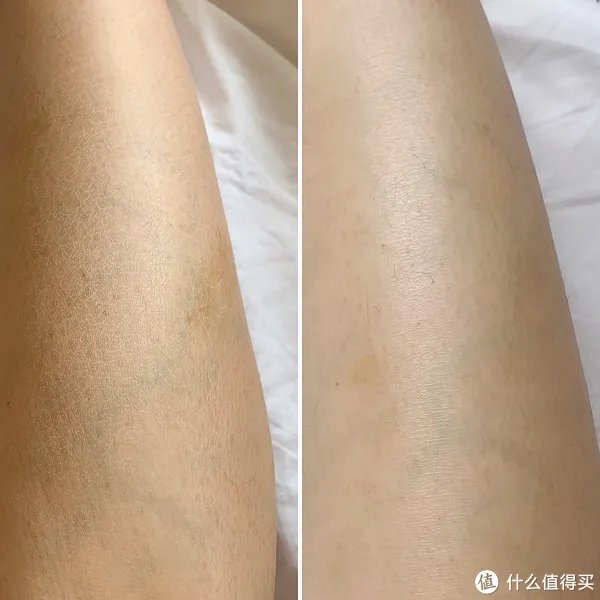 皮肤长期拔干，可能是自来水出了问题——A.O.史密斯美容软水机