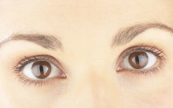 苏州做双眼皮哪几个整形医院口碑好