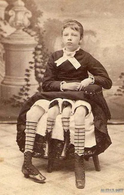 他们都是真实存在！19世纪风靡欧美的“畸形秀”明星