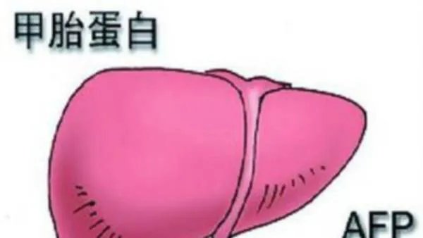 甲胎蛋白是什么意思