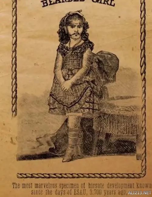 他们都是真实存在！19世纪风靡欧美的“畸形秀”明星