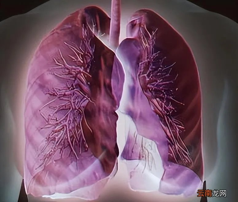 干咳无痰吃什么药 干咳无痰吃什么药效果最好