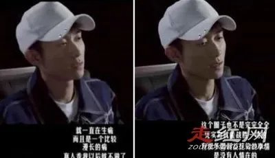 张一山最近身体出现了什么状况 倒下了年仅25岁真的吗