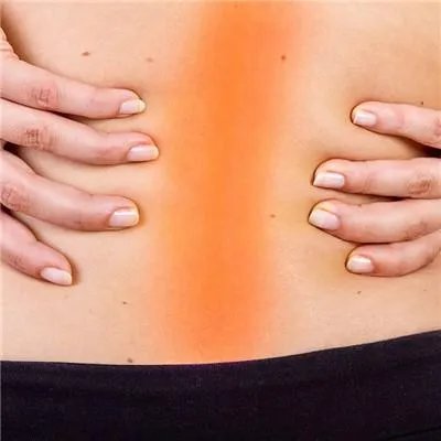 腰肌劳损怎么治疗