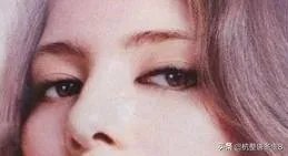 驼峰鼻怎么矫正？