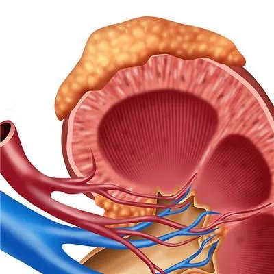 红细胞高是什么原因要紧吗