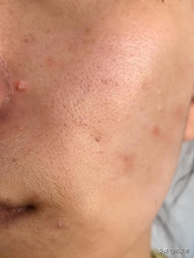 不吃糖真的能漂亮吗?