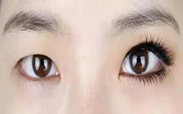 苏州做双眼皮哪几个整形医院口碑好