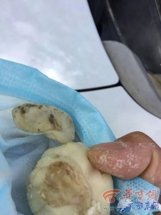 幼儿园疑用变质食材 盘点食物变质四种气味