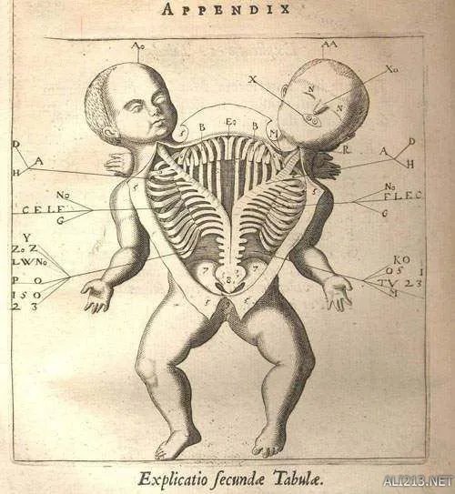 他们都是真实存在！19世纪风靡欧美的“畸形秀”明星