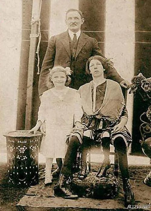 他们都是真实存在！19世纪风靡欧美的“畸形秀”明星