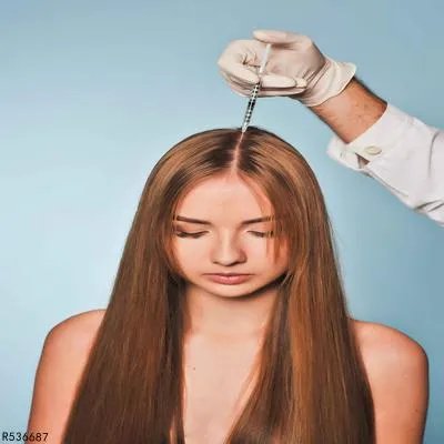 年轻人脱发原因有哪些  四个脱发原因年轻人要警惕