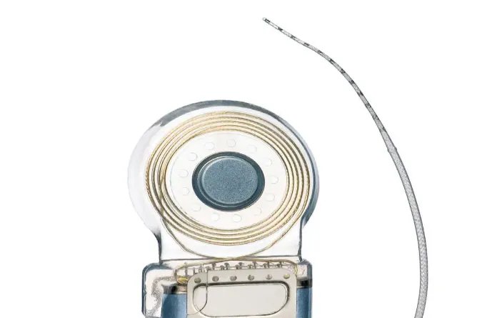 人工耳蜗真实图片