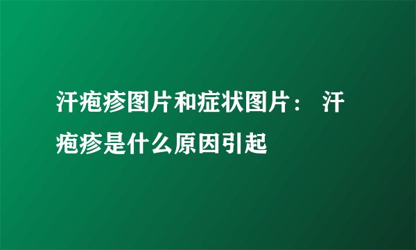 汗疱疹图片和症状图片： 汗疱疹是什么原因引起