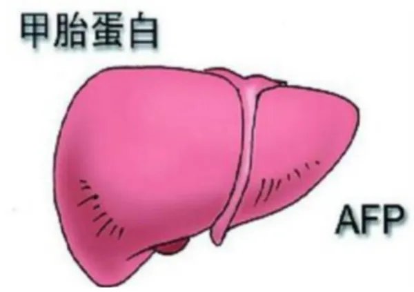 甲胎蛋白是什么意思