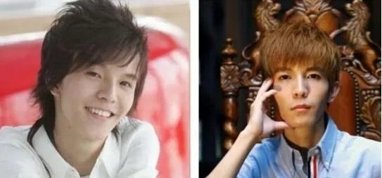 大家对男明星整容有什么看法?