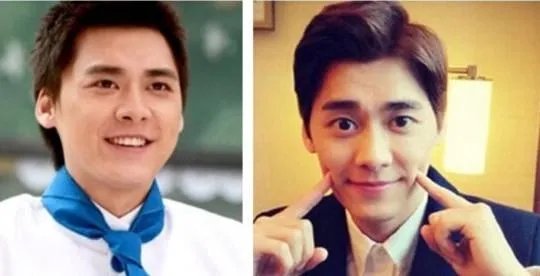 大家对男明星整容有什么看法?