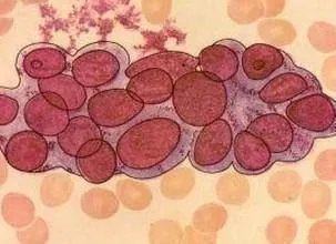 甲胎蛋白是什么意思