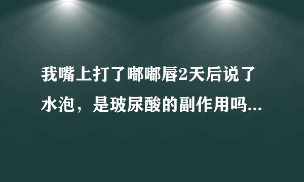 我嘴上打了嘟嘟唇2天后说了水泡，是玻尿酸的副作用吗？还是我自己上火了