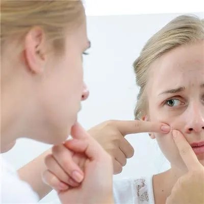 脸上全是痘痘怎么办