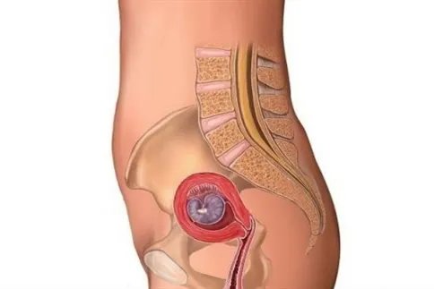 怀孕1一9月肚子变化图过程