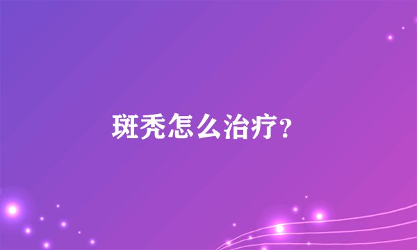 斑秃怎么治疗?