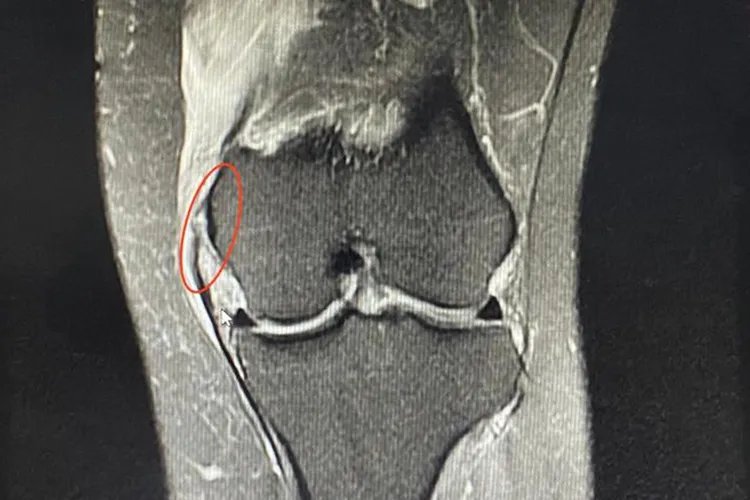 膝盖各个部位疼痛图解