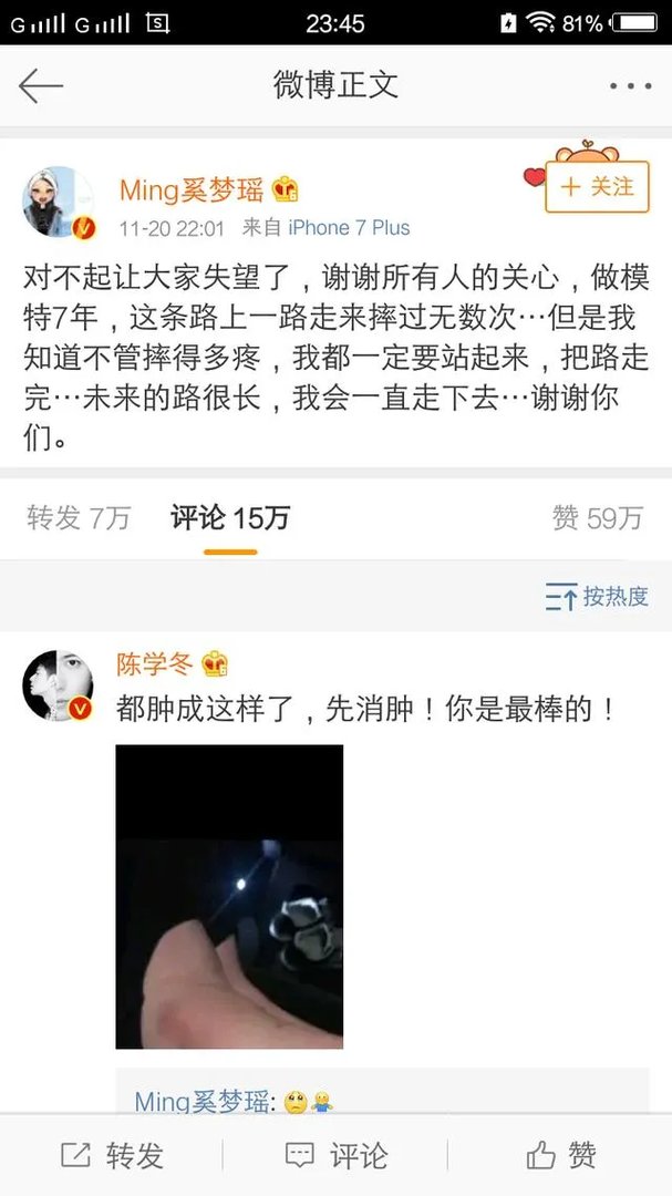 2017维秘秀奚梦瑶摔倒,你怎么看?