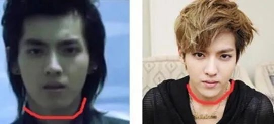 大家对男明星整容有什么看法?