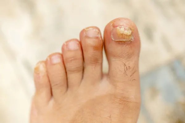 为什么会喜欢闻脚臭的味道