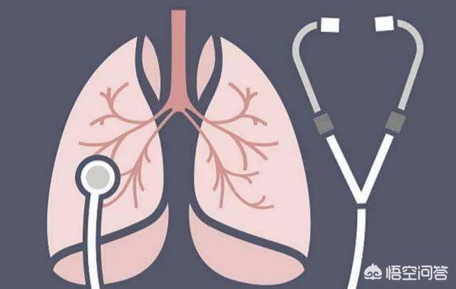 肺癌的的高危人群有哪些？