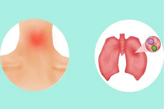 尘肺病能治好吗