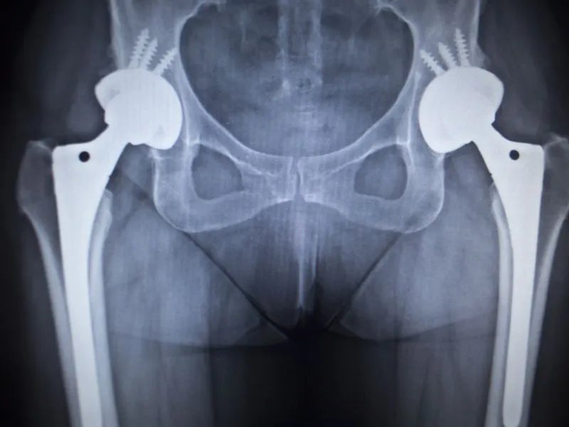 骨骺线在哪个位置