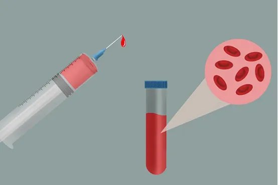 血红蛋白浓度偏高是什么原因